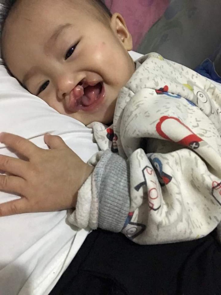 Gia đình dân tộc Tày khó khăn cần 20 triệu đồng phẫu thuật cho con - Ảnh 1.