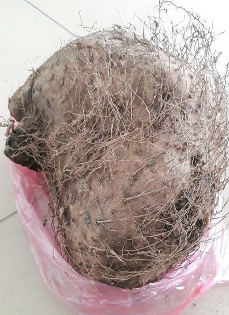 Ăn củ lạ ở rừng, 7 người tại Lào Cai ngộ độc phải nhập viện   - Ảnh 2.