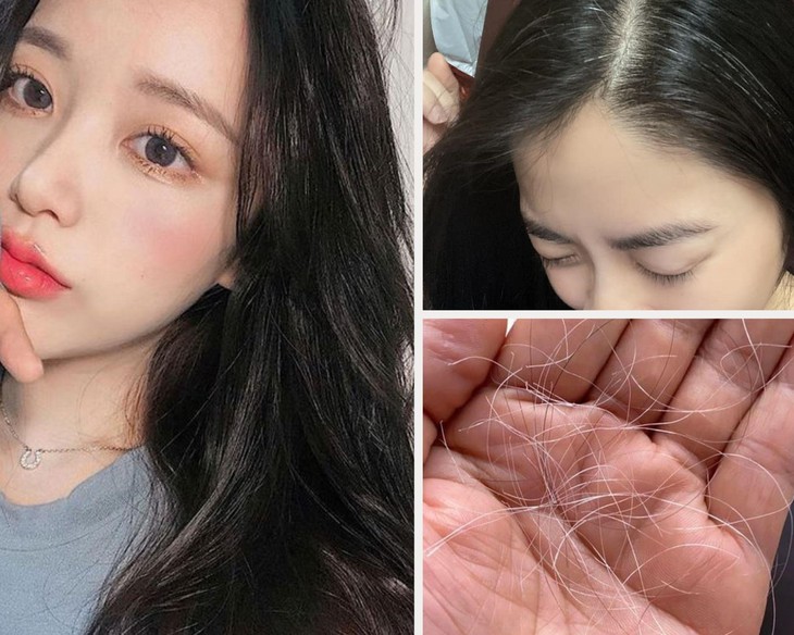 Tóc bạc sớm ở người trẻ, hệ lụy từ thói quen thường ngày ít ai ngờ - Ảnh 1. Tóc bạc sớm ở người trẻ, hệ lụy từ thói quen thường ngày ít ai ngờ - Ảnh 1.