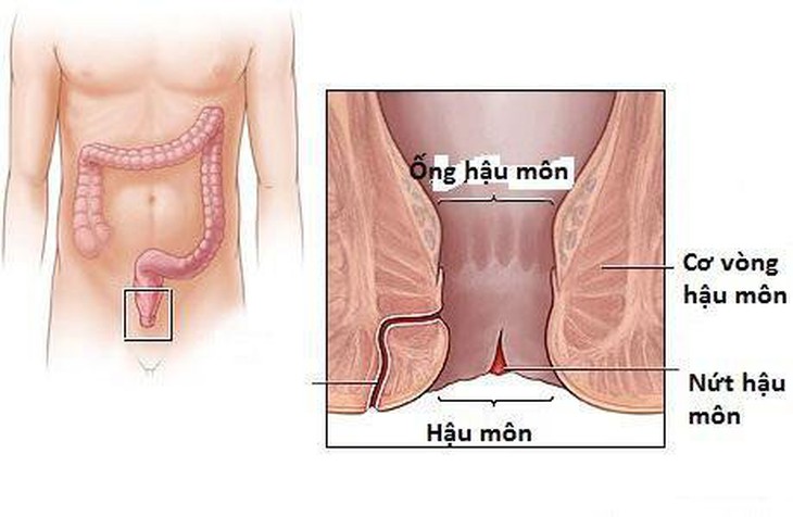 6 nguyên nhân thường gặp gây đau hậu môn và cách khắc phục - Ảnh 3.