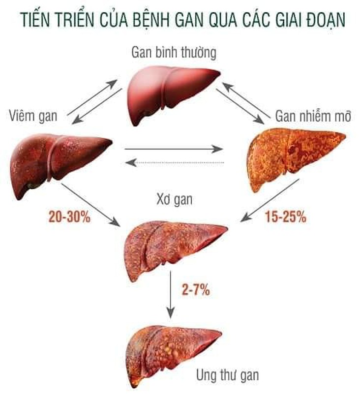 Căn bệnh nguy hiểm khiến ca sĩ Chí Thành mất ở tuổi 25 rất nhiều người mắc phải mà không biết - Ảnh 3. Căn bệnh nguy hiểm khiến ca sĩ Chí Thành mất ở tuổi 25 rất nhiều người mắc phải mà không biết - Ảnh 3.