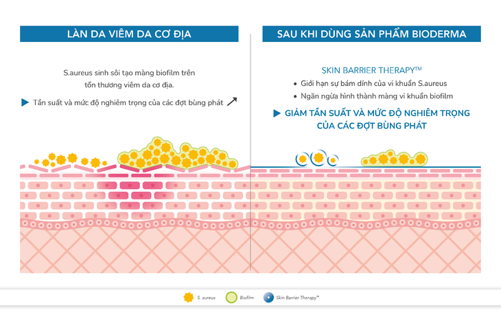 Da khô rát, nứt nẻ - vì đâu và làm sao để khắc phục? - Ảnh 3. Da khô rát, nứt nẻ - vì đâu và làm sao để khắc phục? - Ảnh 3.
