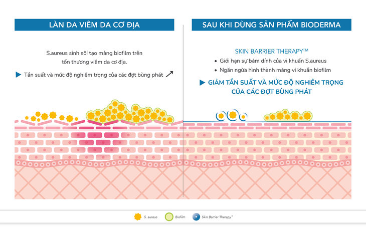 Làm sao để ngăn chặn viêm da dạng chàm bùng phát trong mùa lạnh - Ảnh 3. Làm sao để ngăn chặn viêm da dạng chàm bùng phát trong mùa lạnh - Ảnh 3.