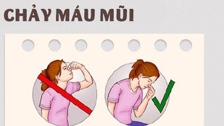 Chảy máu cam ở trẻ gia tăng khi thời tiết hanh khô và cách xử trí - Ảnh 4.