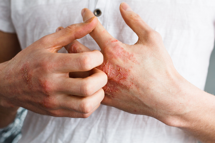 photo-1638432839827