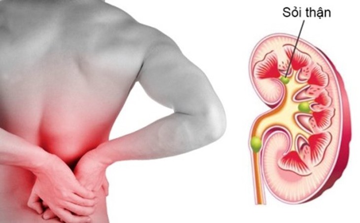 Điều gì sẽ xảy ra khi cơ thể bạn thiếu nước? - Ảnh 4.