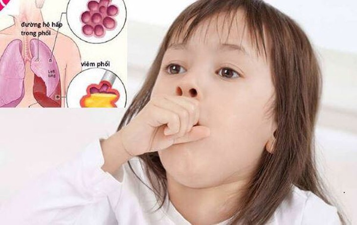 Viêm phổi do virus ở trẻ em: Triệu chứng, điều trị và cách chăm sóc - Ảnh 6.