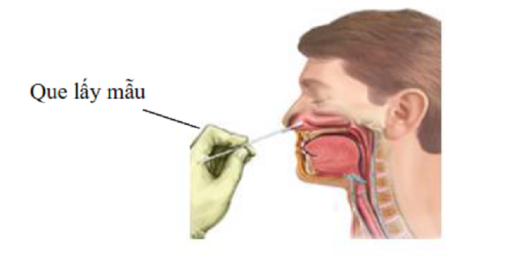 Lưu ý quan trọng khi tự làm test nhanh COVID-19 tại nhà - Ảnh 4.