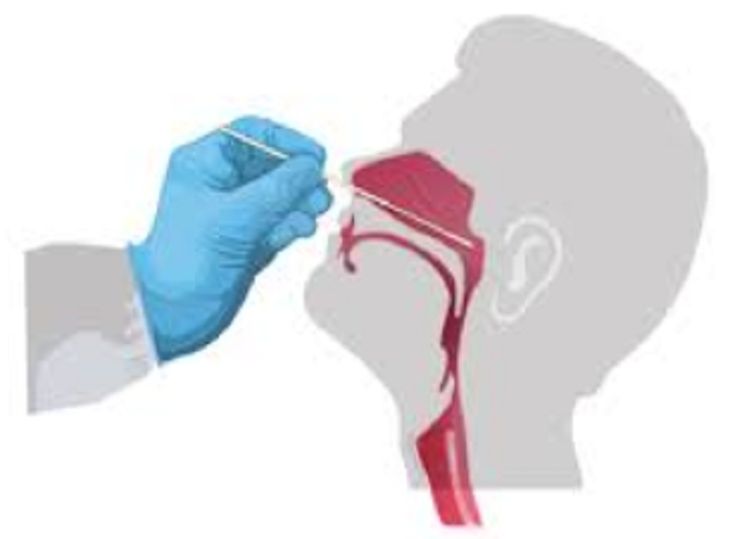 Lưu ý quan trọng khi tự làm test nhanh COVID-19 tại nhà - Ảnh 3.