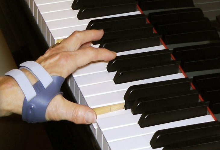 Các cách giúp bệnh viêm khớp dạng thấp không trầm trọng thêm - Ảnh 4.