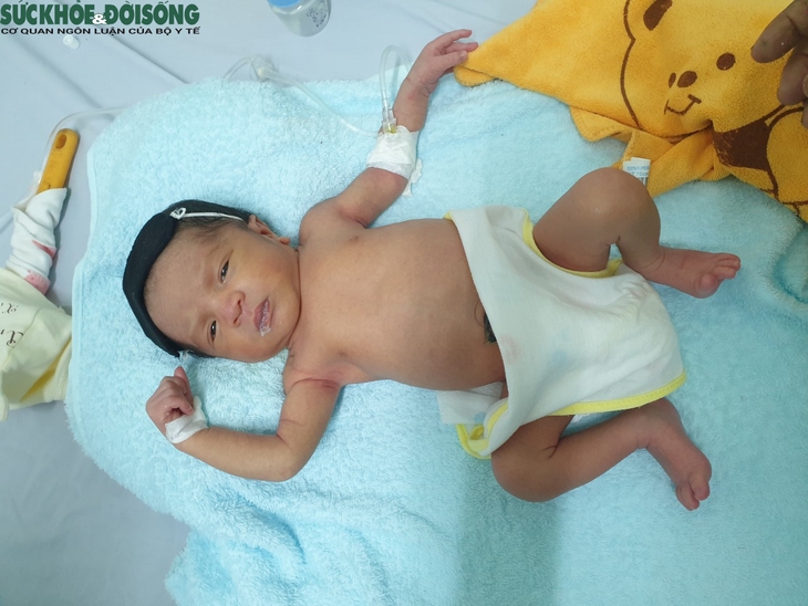 Bão Cytokine bất ngờ ập đến thai phụ mắc COVID-19, bác sĩ vẫn bảo toàn mạng sống cho cả mẹ và con - Ảnh 5.