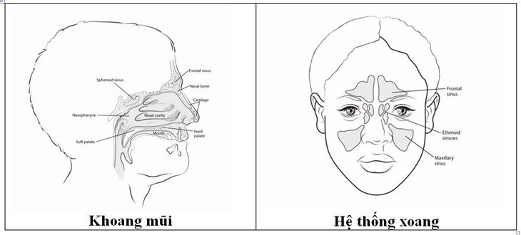 U ác tính mũi xoang: Biểu hiện, phân loại và chẩn đoán - Ảnh 1. U ác tính mũi xoang: Biểu hiện, phân loại và chẩn đoán - Ảnh 1.