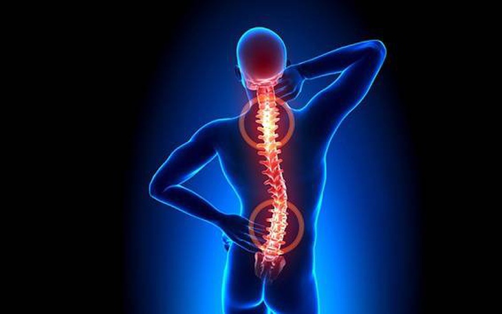 Cách nào trị viêm cột sống dính khớp?