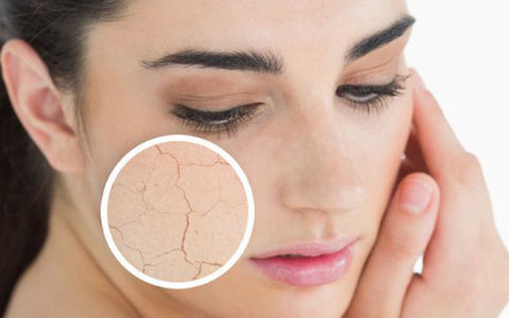 Da khô nên bổ sung vitamin và khoáng chất gì?