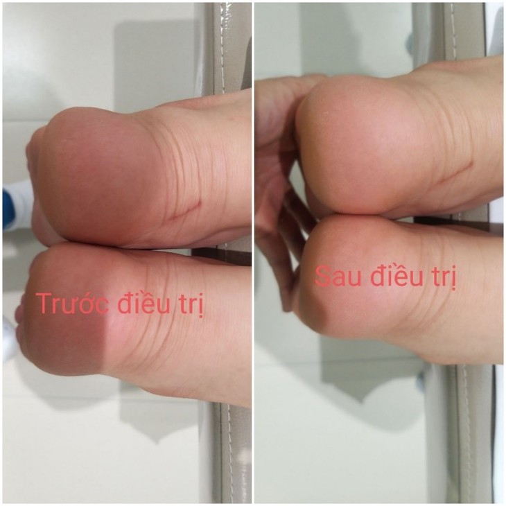 Cảnh báo tư thế làm việc xấu của dân văn phòng gây lệch khớp xương chậu và phương pháp điều trị - Ảnh 3. Cảnh báo tư thế làm việc xấu của dân văn phòng gây lệch khớp xương chậu và phương pháp điều trị - Ảnh 3.