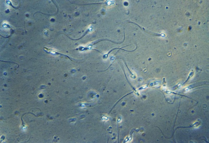 https___specials-images.forbesimg.com_imageserve_60d01f903e91fef7b998b622_Human-spermatozoa---_960x0.jpg