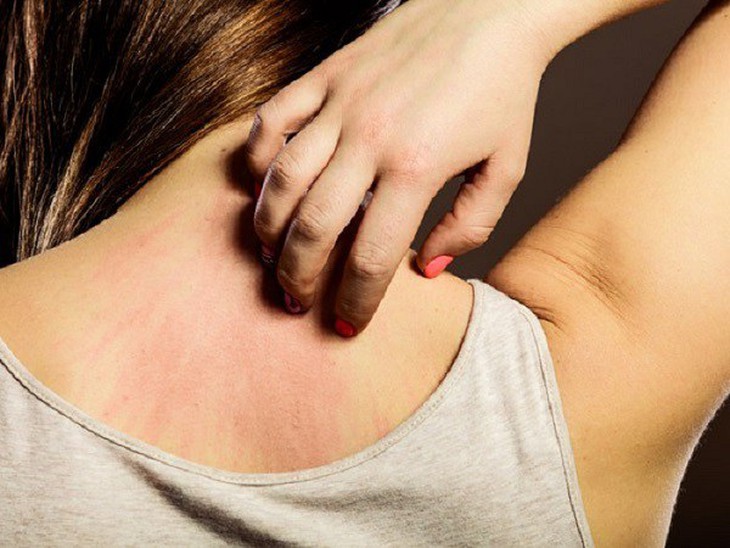 Bác sĩ da liễu chỉ ra 2 thói quen sai lầm khiến da bạn nứt nẻ vào mùa lạnh - Ảnh 2.