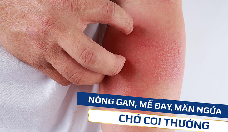 7 dấu hiệu cảnh báo gan tổn thương, nhiễm độc tố - Ảnh 1.