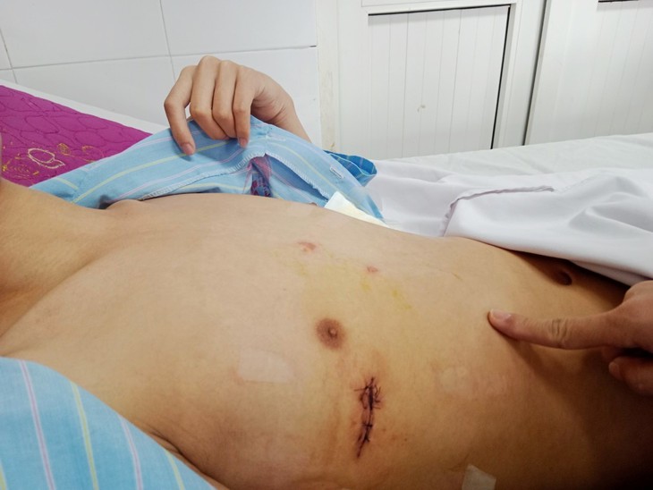Bệnh viện HNĐK Nghệ An điều trị thành công bệnh ngực lõm bẩm sinh - Ảnh 3.
