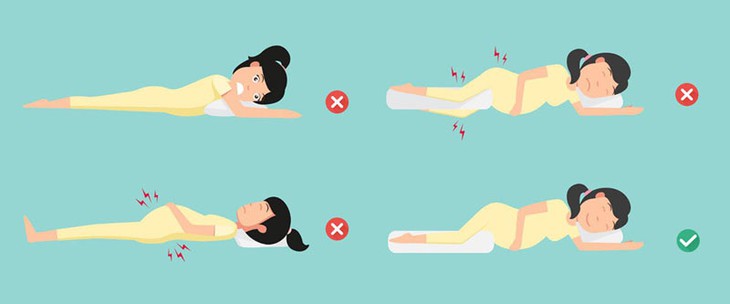 Cần làm gì để giảm đau lưng trong thai kỳ? - Ảnh 2.