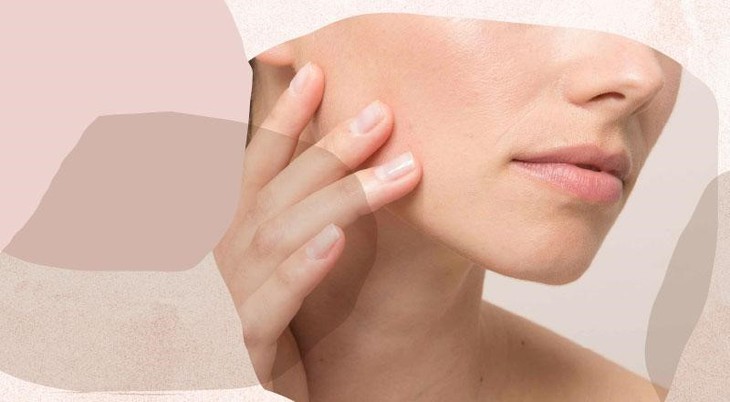Tranexamic Acid có gây kích ứng da? - Ảnh 3.