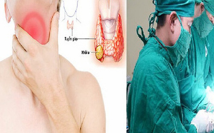 Ung thư tuyến giáp di căn sau 16 năm được cứu sống ngoạn mục
