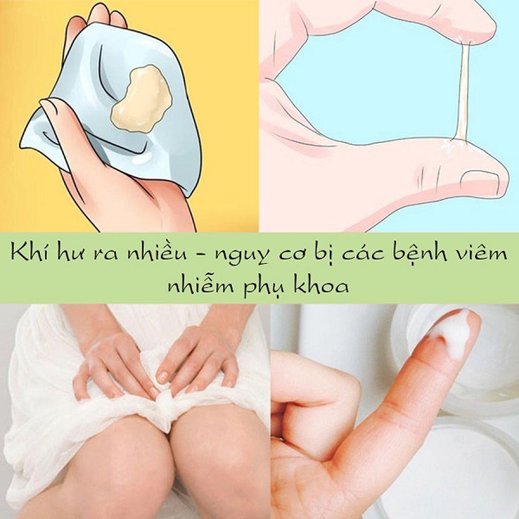 Chuyện của “cô bé” mà không “bé”: Dừng ngay hôm nay những thói quen sai lầm khi chăm sóc “cô bé” hằng ngày - Ảnh 5.