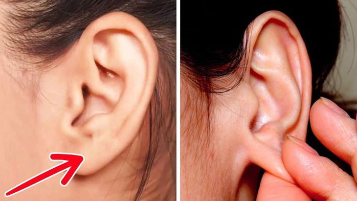 Xoa bóp trị đau đầu - Ảnh 1.