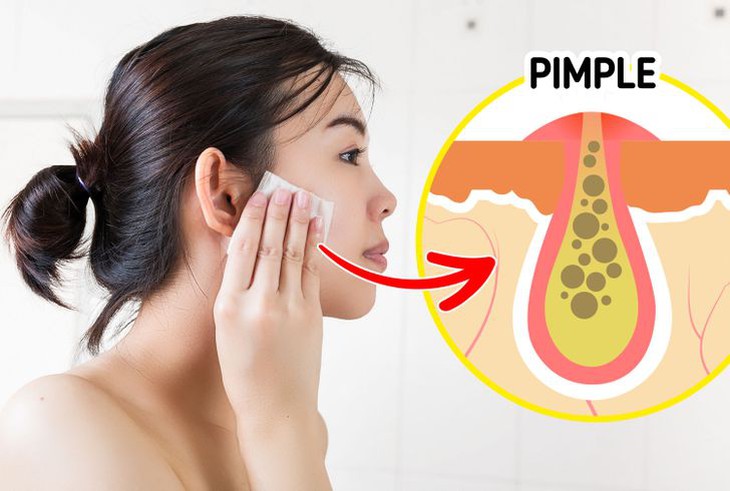 10 việc gây hại da bạn vẫn làm hàng ngày - Ảnh 3. 10 việc gây hại da bạn vẫn làm hàng ngày - Ảnh 3.