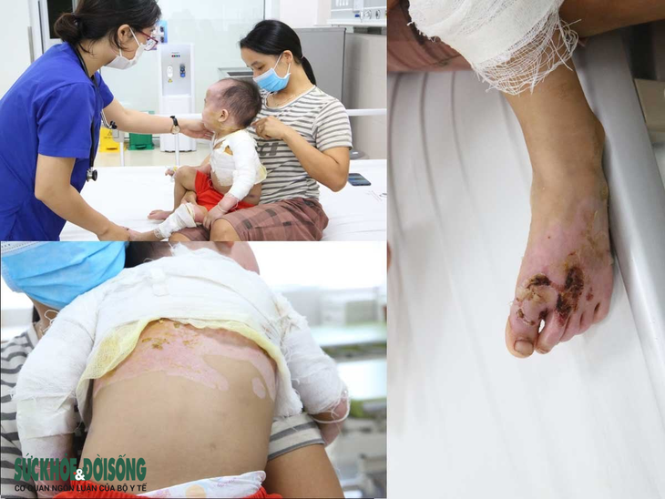 Trượt chân ngã xuống suối, bé gái suy hô hấp, viêm phổi nặng - Ảnh 4.