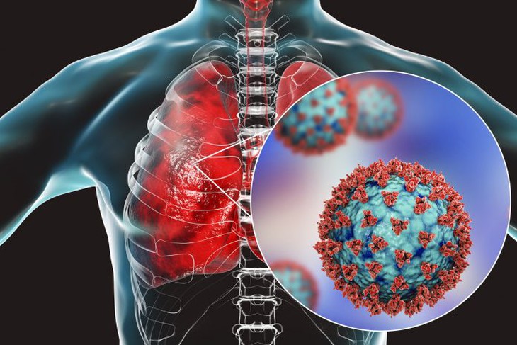 Vaccine COVID-19 có thể bảo vệ phổi của bệnh nhân. - Ảnh 1.
