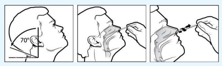 Hướng dẫn lấy mẫu, thực hiện test nhanh SARS-CoV-2 tại nhà - Ảnh 3.