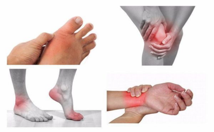 Những cách khắc phục tê bì chân tay hiện nay - Ảnh 1.
