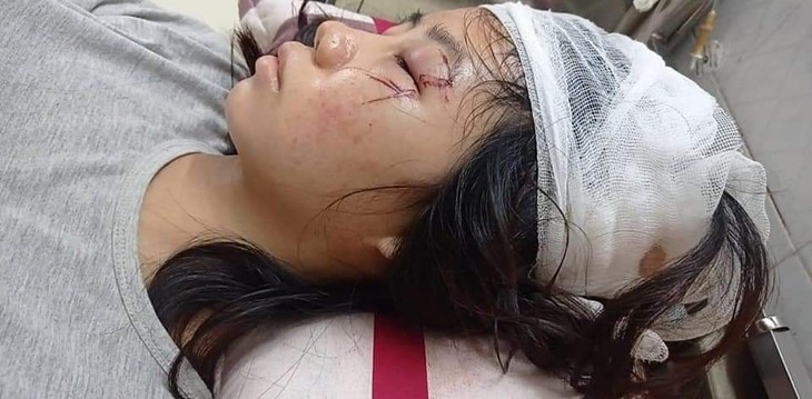 Bố bỏ đi, mẹ mất vì ung thư, hai chị em nguy kịch vì tai nạn không tiền điều trị - Ảnh 2.