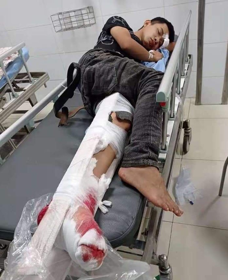 Bố bỏ đi, mẹ mất vì ung thư, hai chị em nguy kịch vì tai nạn không tiền điều trị - Ảnh 3.
