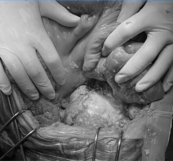 Ngại đi khám bệnh vì giãn cách xã hội, nhiều người bệnh nhẹ hoá nguy - Ảnh 2.