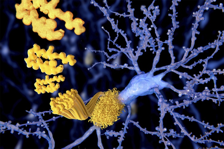 9 thói quen tốt giúp ngăn ngừa bệnh Alzheimer - Ảnh 1.