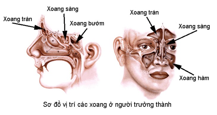 Bệnh viêm xoang cấp: Nguyên nhân, triệu chứng, phòng ngừa và một số phương pháp điều trị