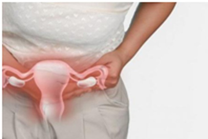 Trong những trường hợp hiếm gặp, khối u xơ có cuống có thể phát triển trong tử cung.