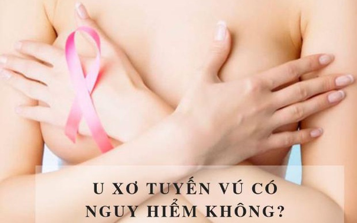 U xơ tuyến vú có đáng lo?