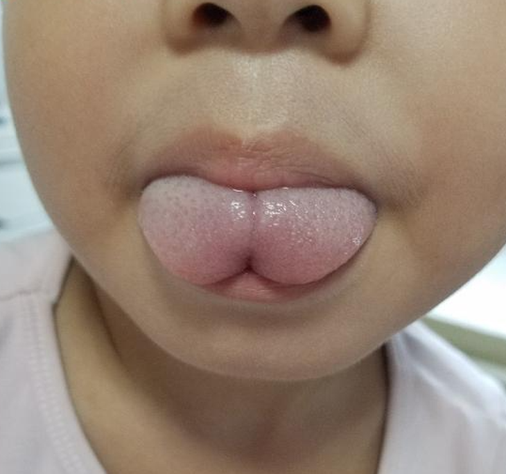 Hóa ra đây là nguyên nhân khiến trẻ dù lớn vẫn nói "ngọng líu ngọng lô" - Ảnh 3. photo-1630301583909