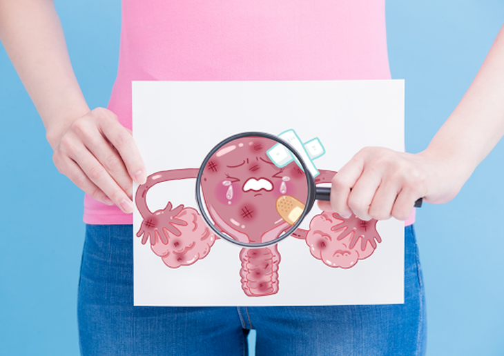3 nguyên nhân không đậu thai khi IVF  và cách khắc phục - Ảnh 3.
