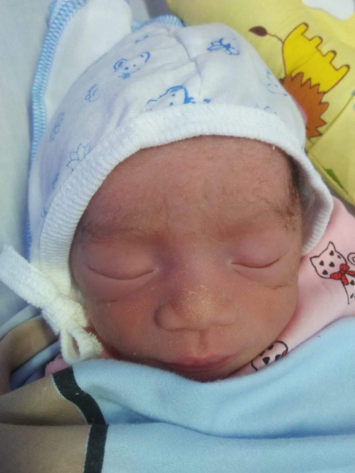 Sản phụ sau sinh hơn tháng chưa một lần gặp con, giờ nguy kịch vì biến chứng hậu sản - Ảnh 3.