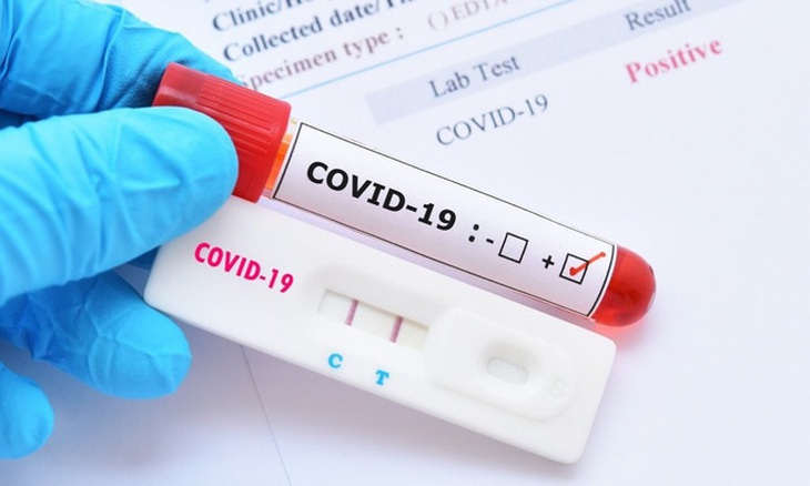 Bộ Y tế: Các địa phương lập đoàn kiểm tra việc kinh doanh test kit xét nghiệm nhanh và PCR - Ảnh 1. Bộ Y tế: Các địa phương lập đoàn kiểm tra việc kinh doanh test kit xét nghiệm nhanh và PCR - Ảnh 1.