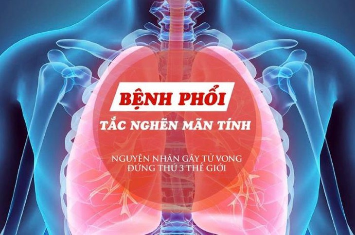 Chú ý đặc biệt cho bệnh nhân COPD tiêm vaccine phòng COVID-19? - Ảnh 2.