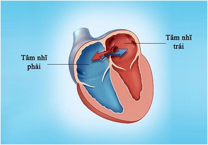 "Giải cứu" những trái tim bé thơ chưa hoàn thiện - Ảnh 2.