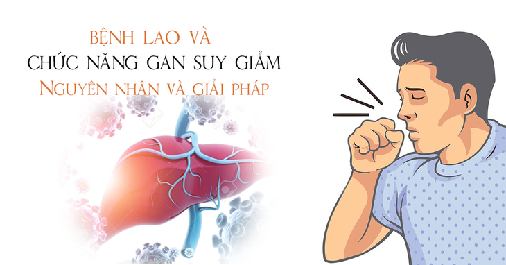 Bệnh lao và chức năng gan suy giảm - Nguyên nhân và giải pháp - Ảnh 1. Bệnh lao và chức năng gan suy giảm - Nguyên nhân và giải pháp - Ảnh 1.