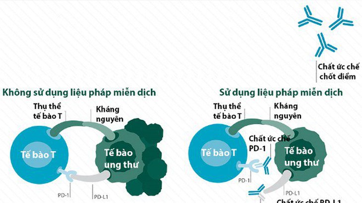 Phối hợp xạ trị và thuốc điều trị ung thư phổi cải thiện sự sống còn - Ảnh 1. Phối hợp xạ trị và thuốc điều trị ung thư phổi cải thiện sự sống còn - Ảnh 1.