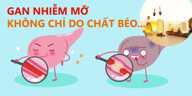 4 "kẻ thù giấu mặt" gây bệnh gan nhiễm mỡ - Ảnh 1. 4 "kẻ thù giấu mặt" gây bệnh gan nhiễm mỡ - Ảnh 1.