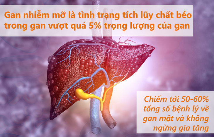 4 "kẻ thù giấu mặt" gây bệnh gan nhiễm mỡ - Ảnh 2. 4 "kẻ thù giấu mặt" gây bệnh gan nhiễm mỡ - Ảnh 2.